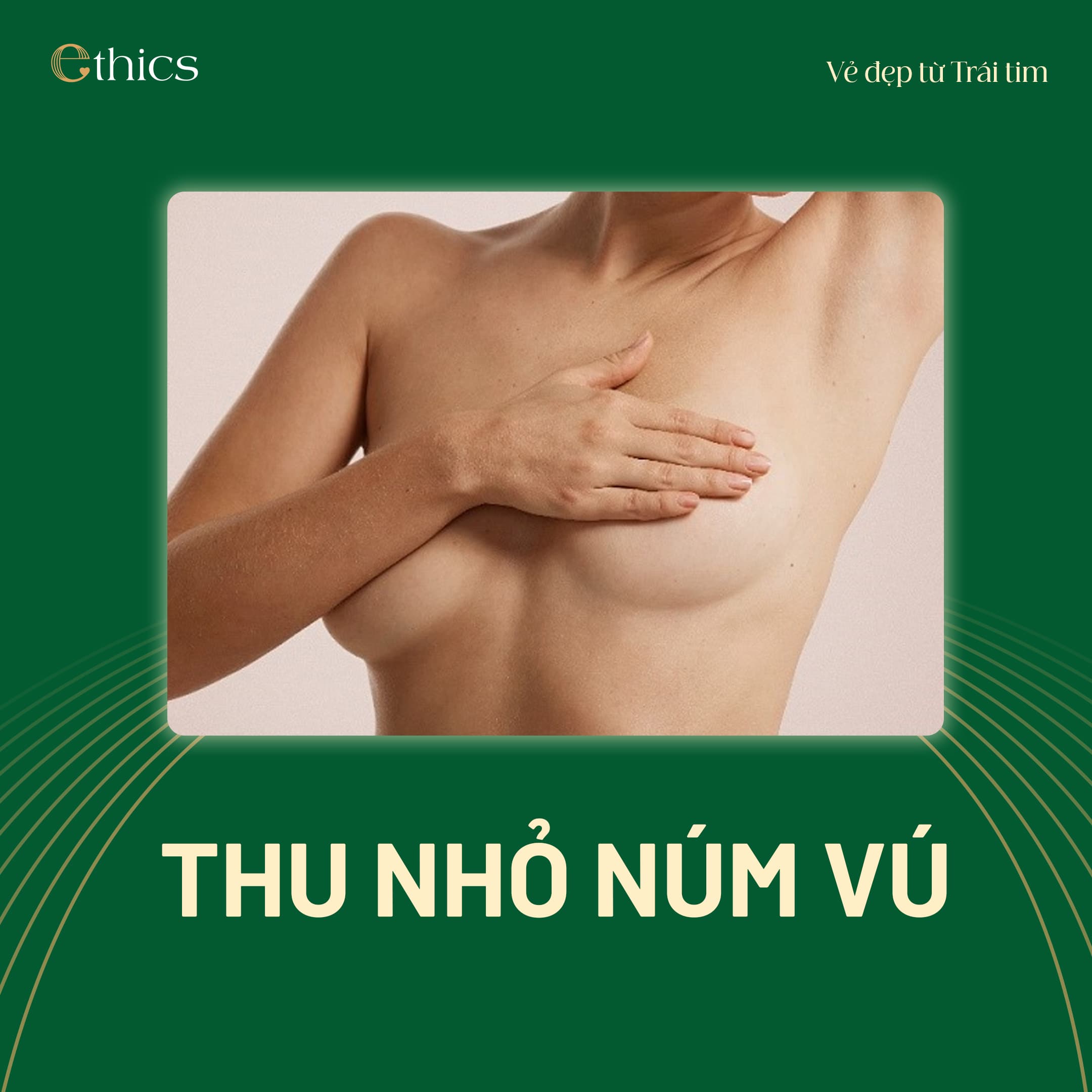Thu nhỏ núm vú