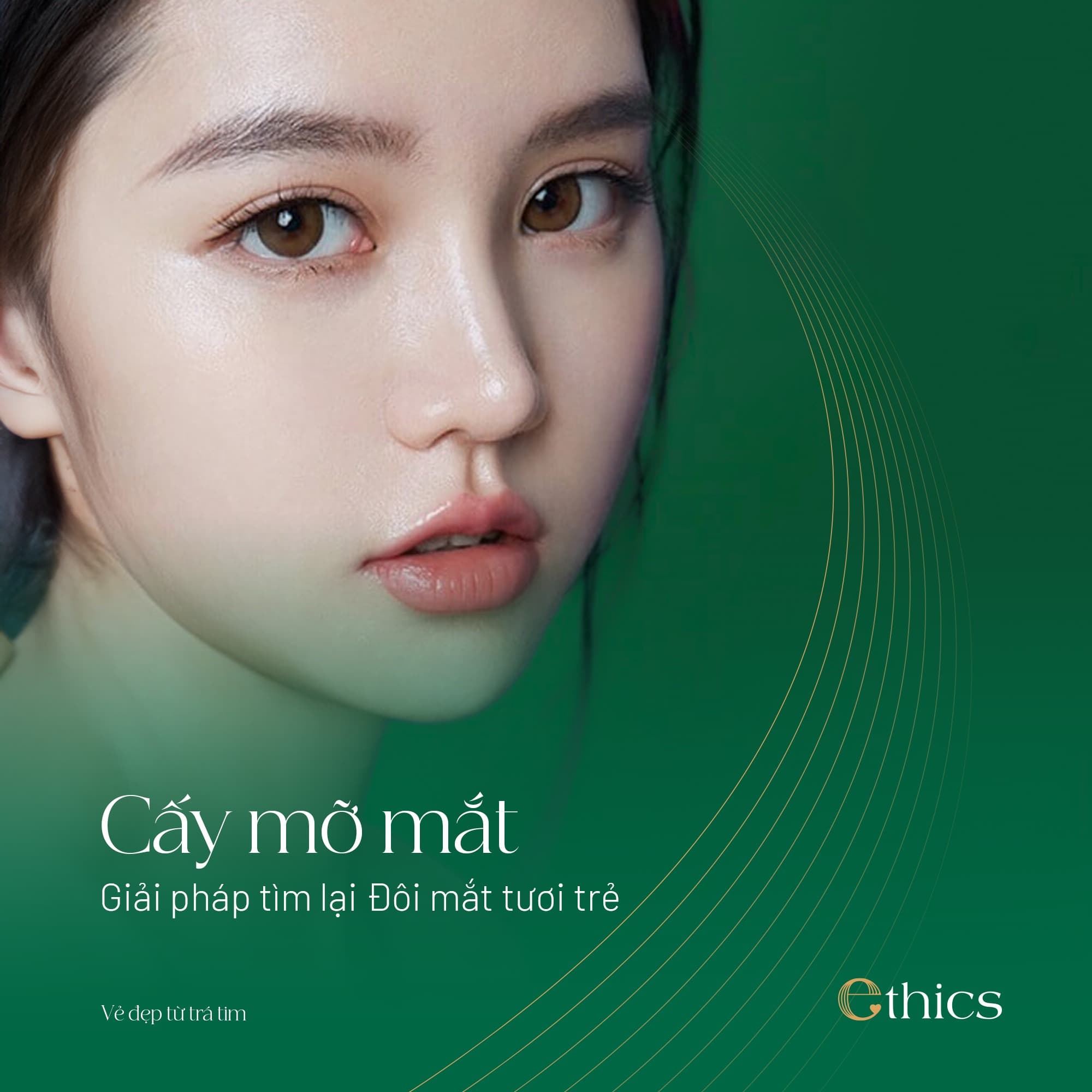 Cấy mỡ má
