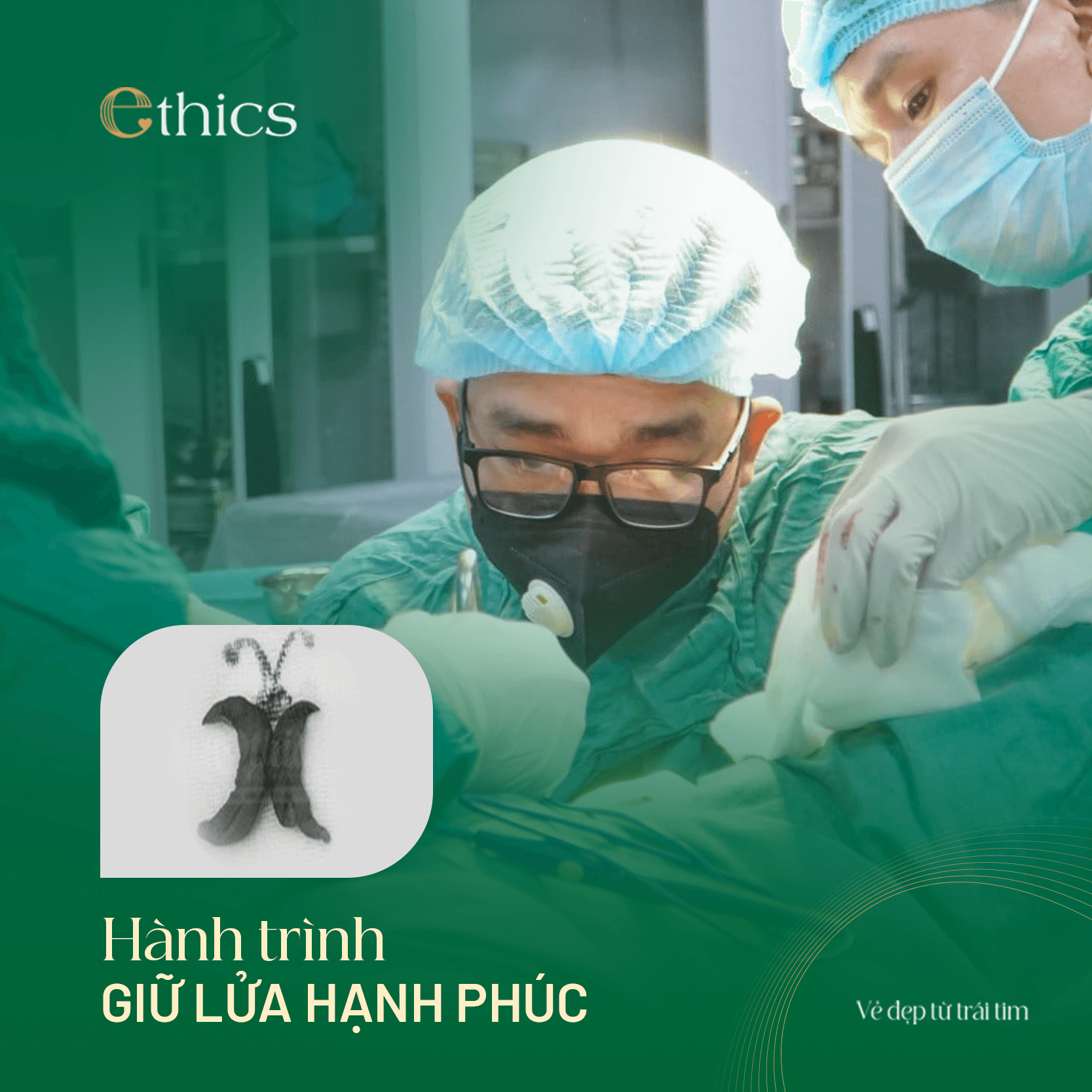 Thẩm mỹ căng môi lớn