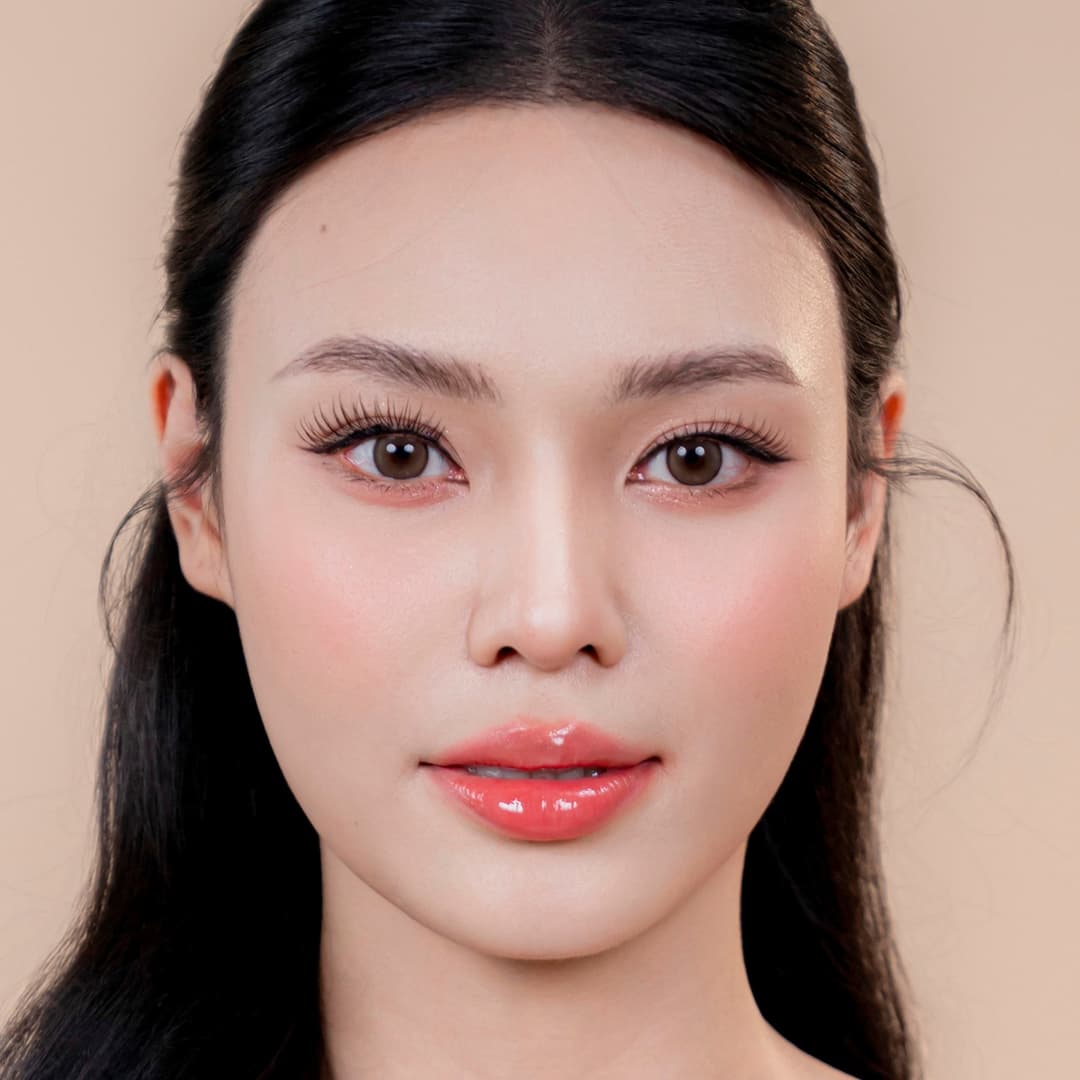 Khách hàng Lưu Phương Anh - Sau can thiệp nâng mũi One fit (Cận cảnh)