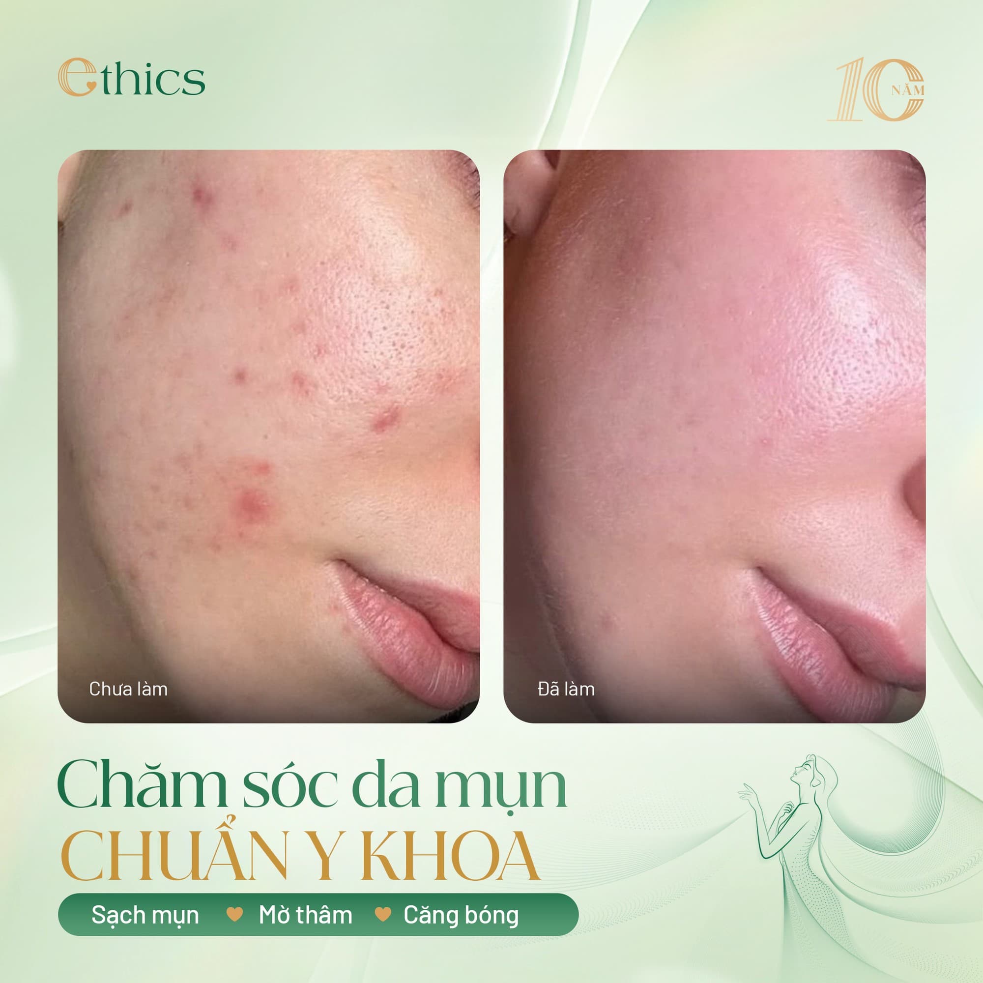 Chăm sóc phục hồi da chuyên sâu