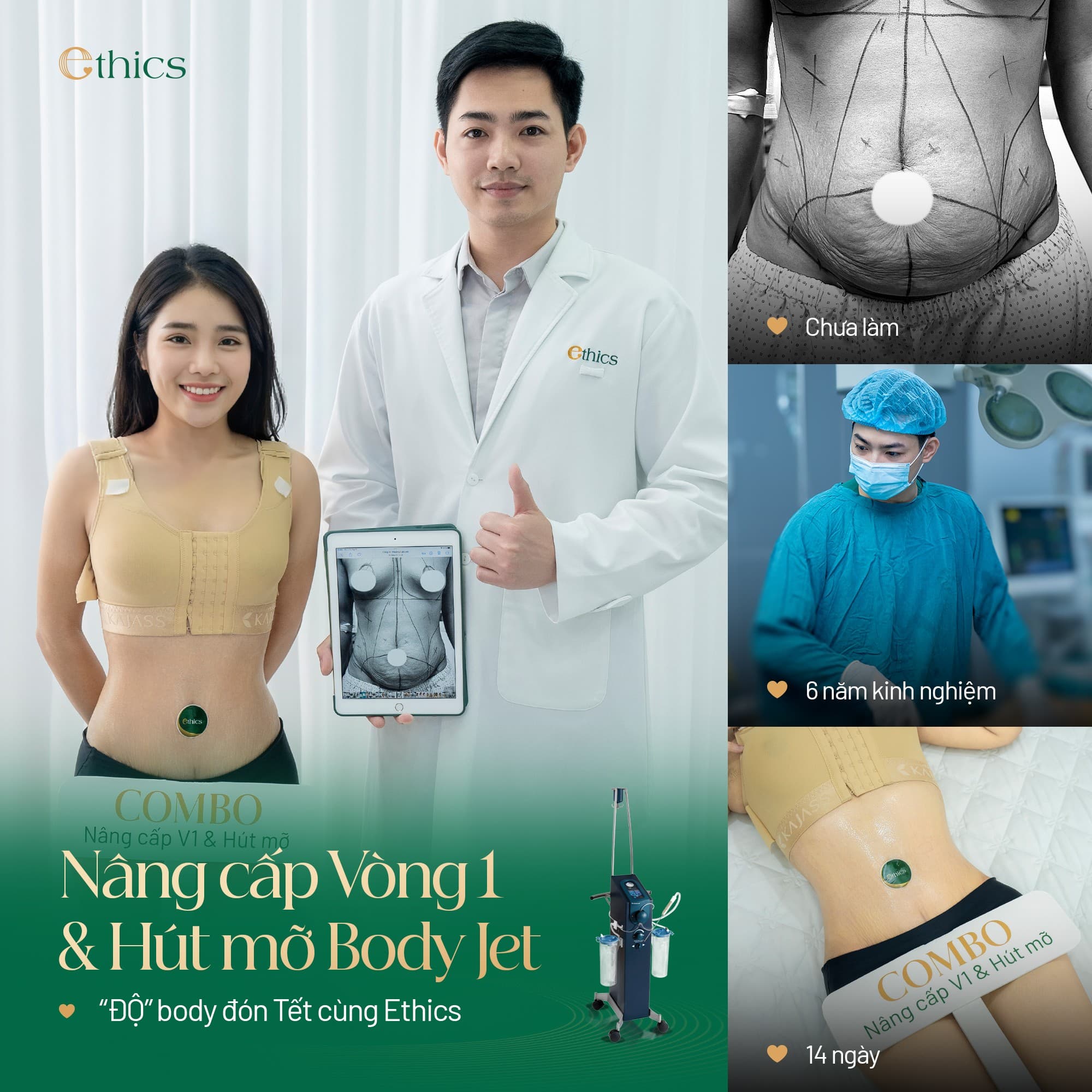 Kéo núm vú tụt / bệnh vú