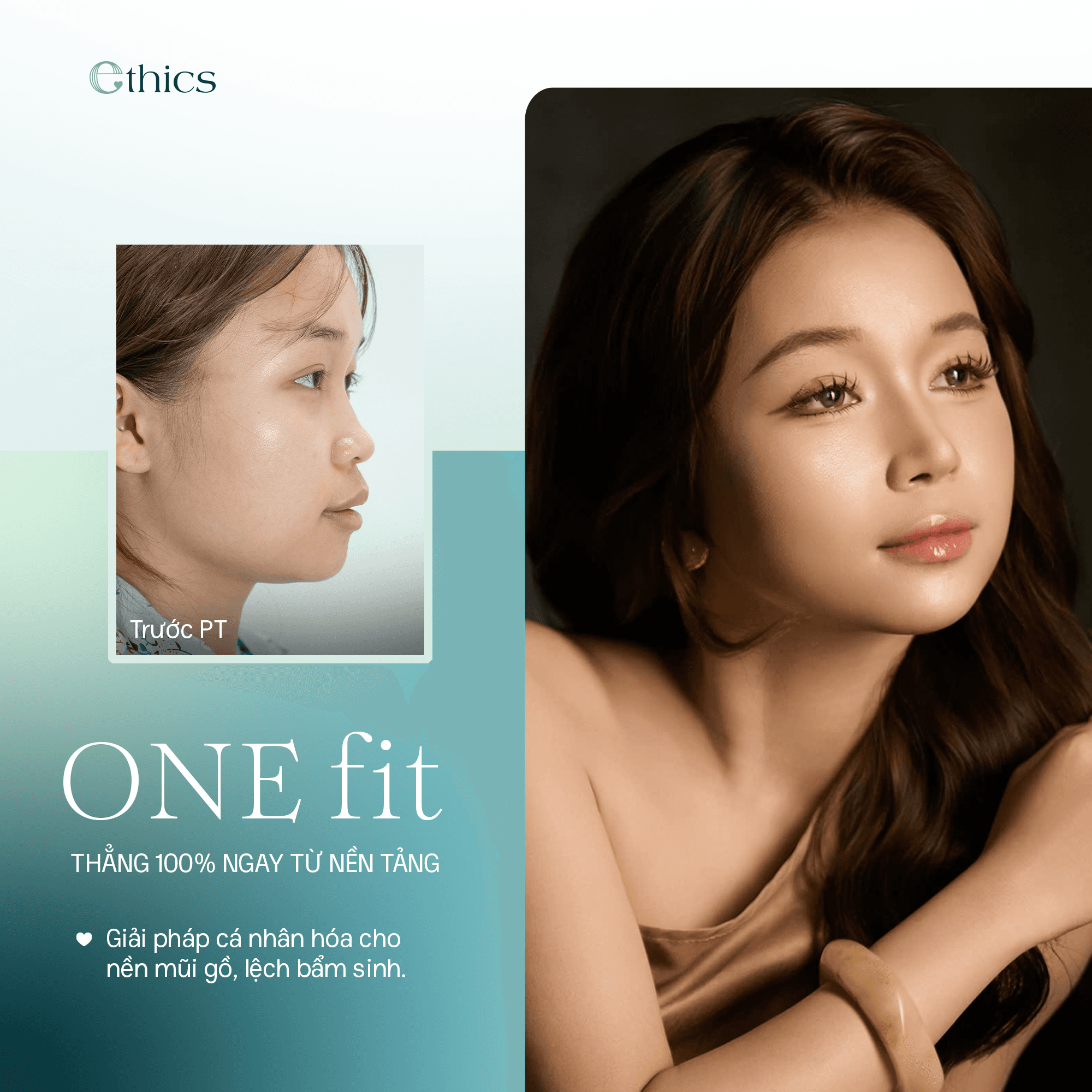 Độn cằm OneFit