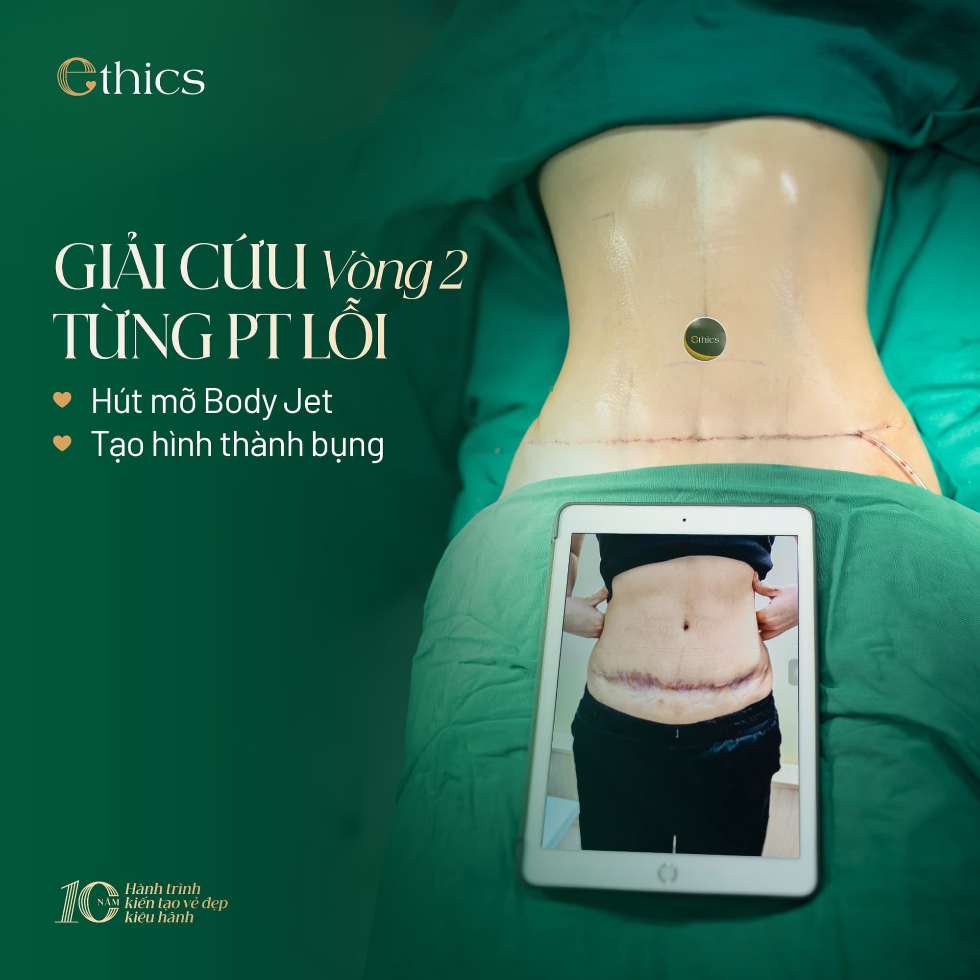 Tạo hình toàn thể – vòng eo từ 100 cm