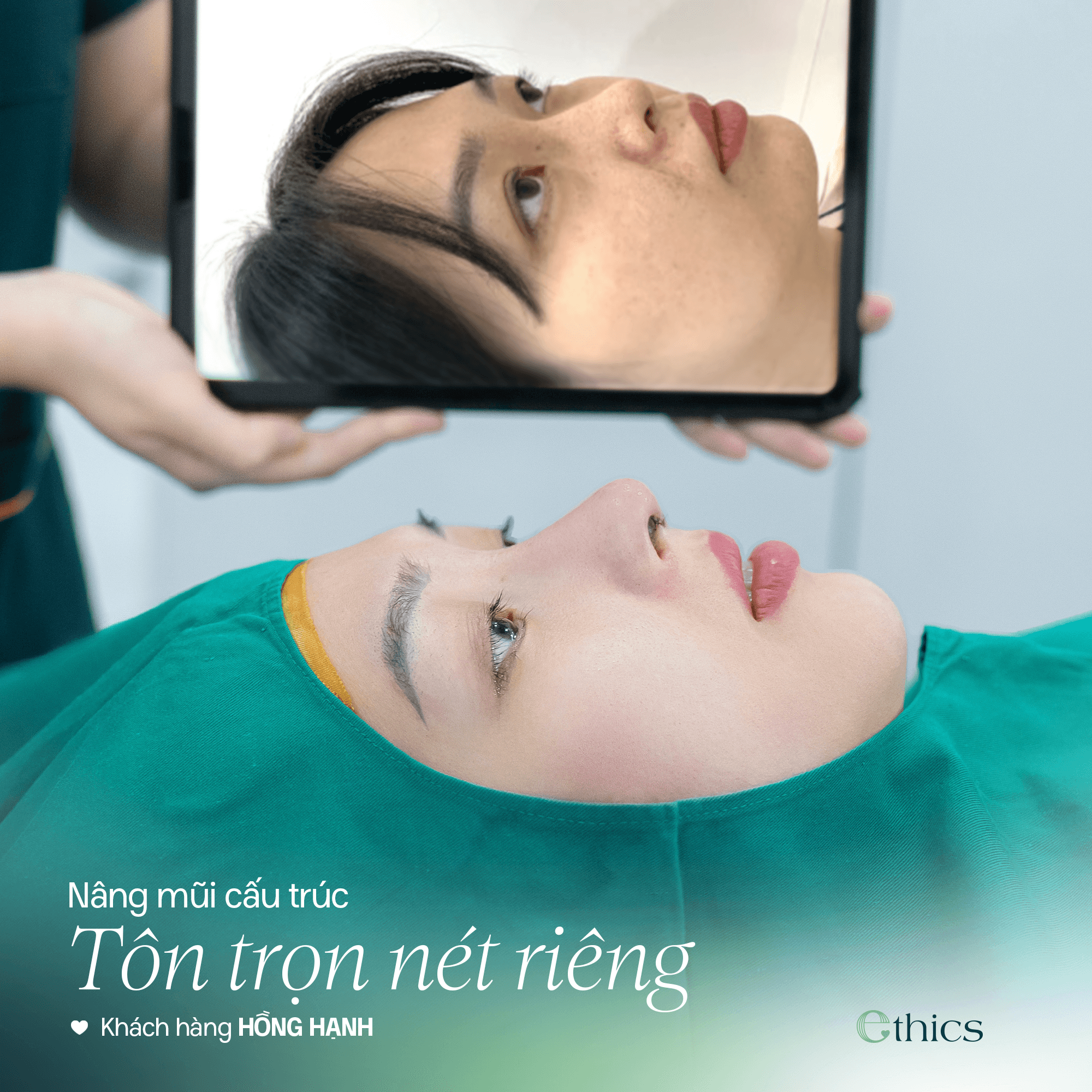 GÓC NGHIÊNG THANH TÚ - TÔN TRỌN NÉT RIÊNG CÙNG NÂNG MŨI CẤU TRÚC