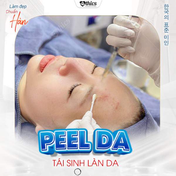 Peel da – Liệu pháp hoàn hảo tái sinh làn da mới