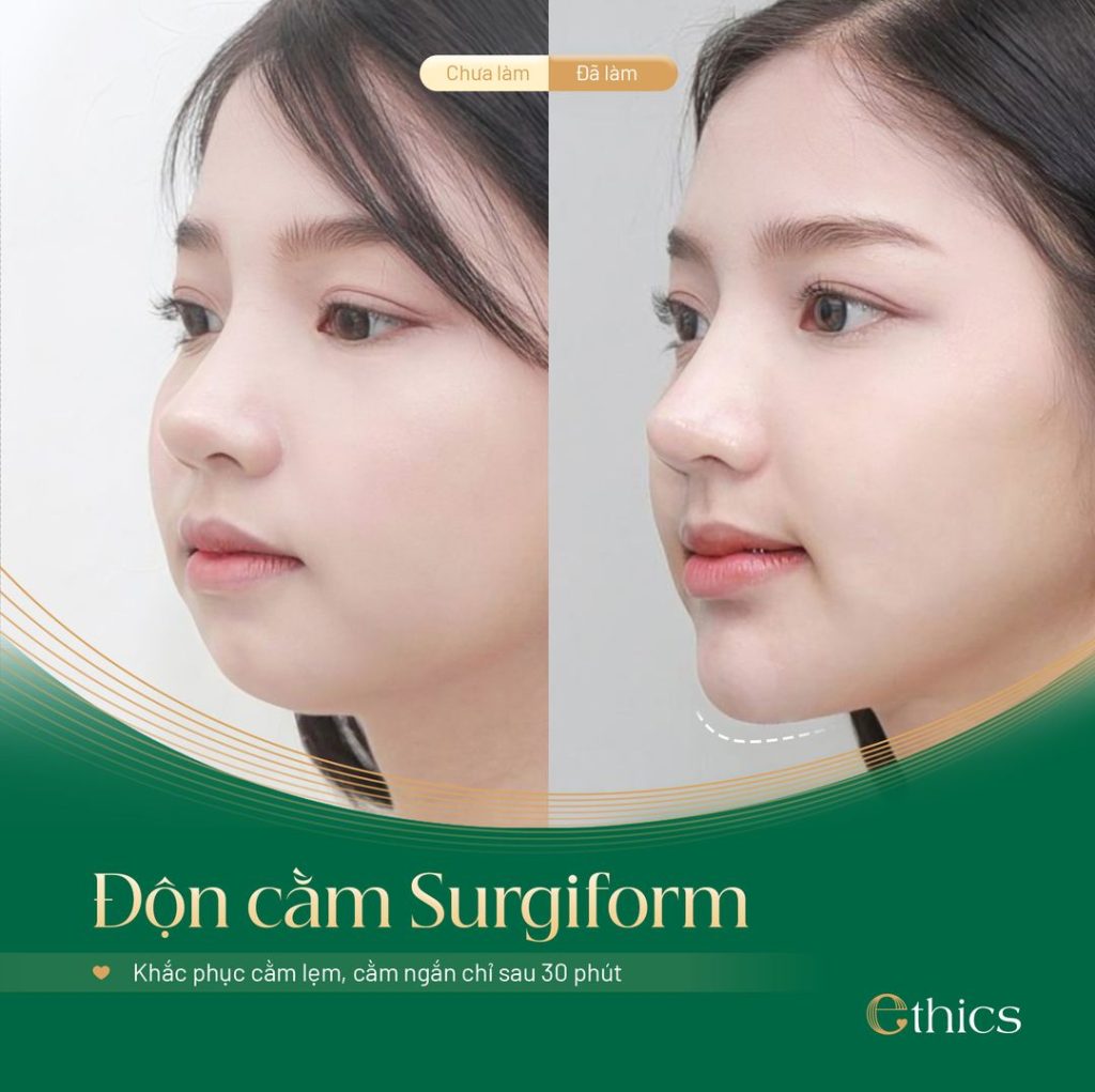 Độn cằm Surgiform