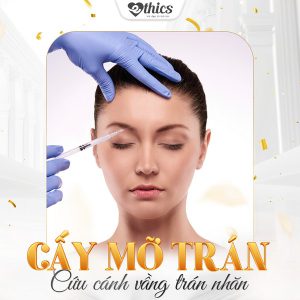 Cấy mỡ trán – Bí quyết sở hữu vầng trán thanh tú đầy đặn