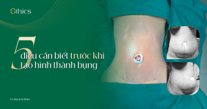 5 điều cần biết trước khi tạo hình thành bụng