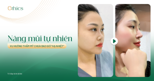 Nâng mũi tự nhiên – Xu hướng thẩm mỹ chưa bao giờ hạ nhiệt