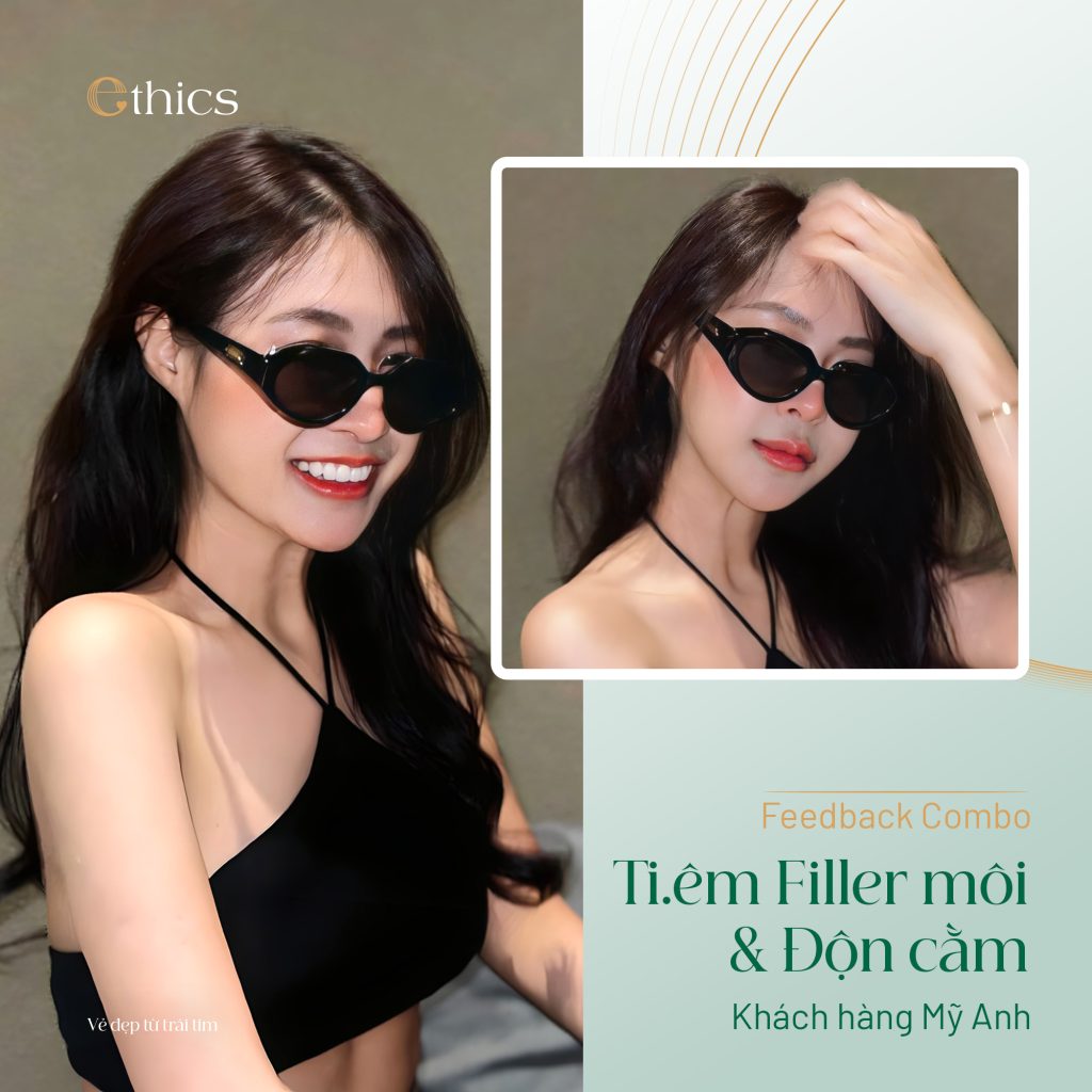 Combo filler môi & Độn cằm Ethics