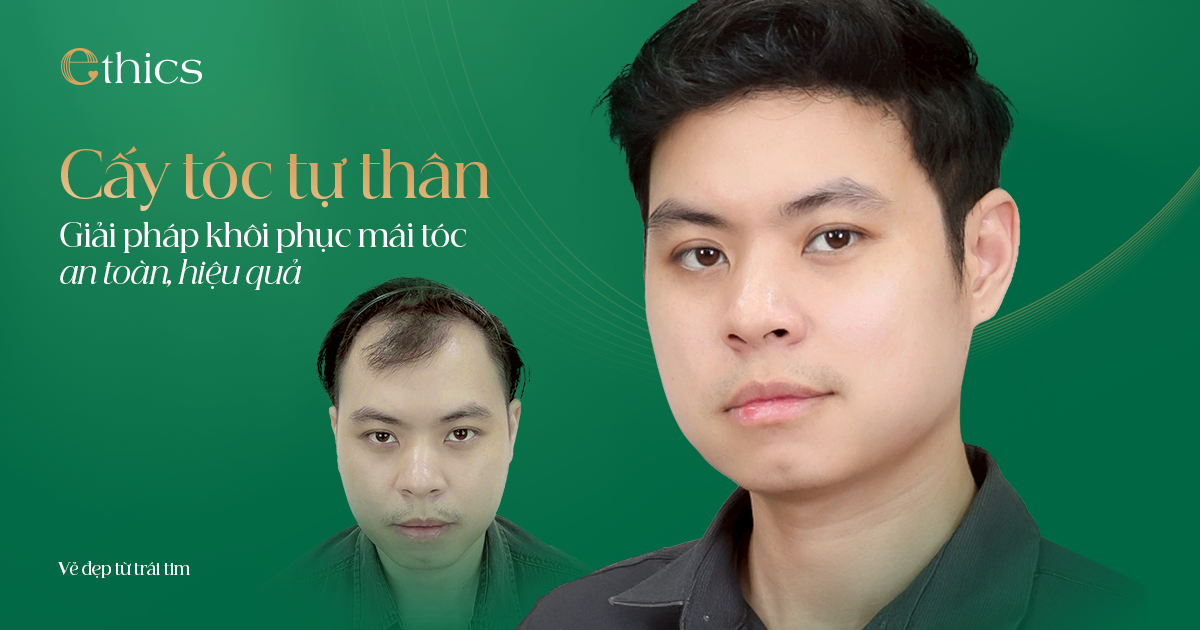 Cấy tóc tự thân tại Ethics